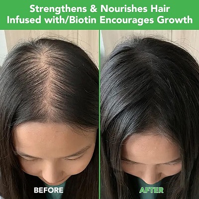 rosemary shampoo for hair growth : Before and After use