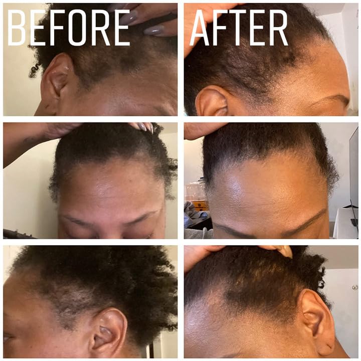 Customer Reviews and Testimonials of jamaican black castor oil for hair growth