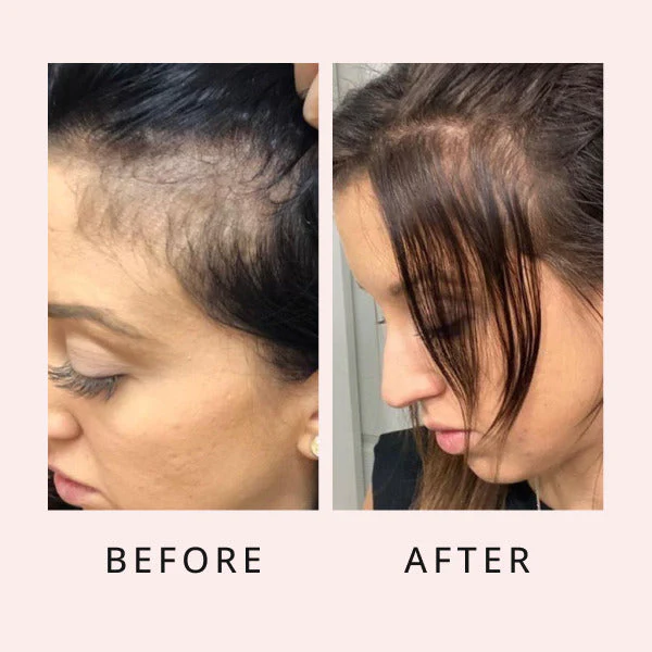 2.Before and After the use of luxe hair growth serum images