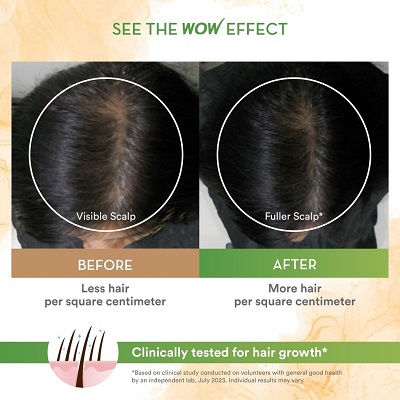 rosemary shampoo for hair growth BEFORE AND AFTER  USE 